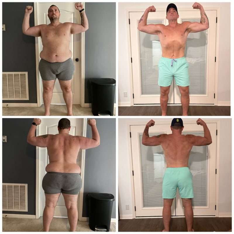 New Treatment For Fatty Liver Disease